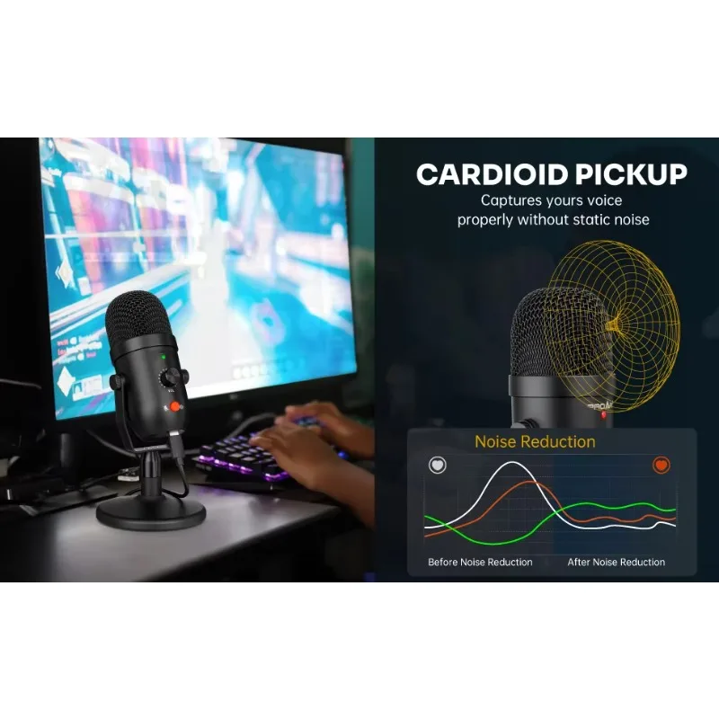 Professionelles USB-Mikrofon für Musikaufnahmen, Podcasting, Studioausrüstung, Kabelgebundene Verbindung für PC-Gaming, aus Metall und Kunststoff