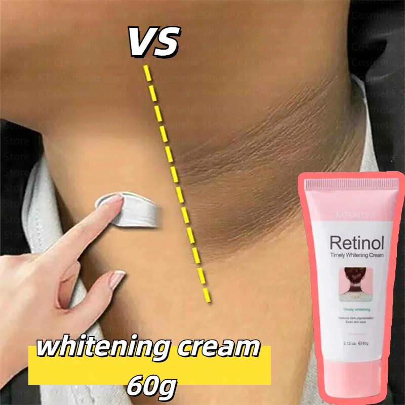 

Retinol Timely Whitening Cream Reduce Dark Pigmentation Even Skin Tone Neck Underarm Knee Brighten Moisturizer Care Beauty 60g