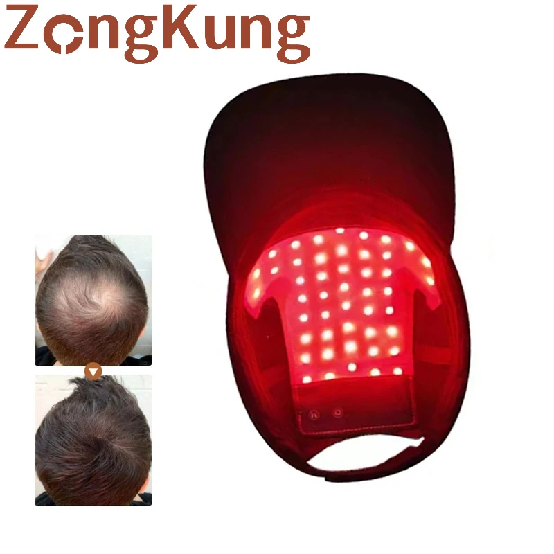 Red&Blue Light Therapy  Cap Hair Fast Growth Red & Infrared Light Therapy Device For Hair Loss Treatment With USB Charging