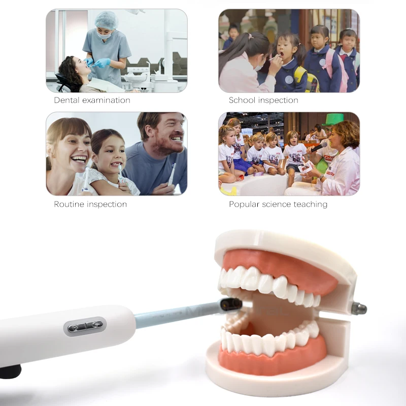 กล้อง Intraoral ทันตกรรมไร้สาย WiFi 2 ล้านพิกเซล 7 เลนส์ HD กล้องตรวจสอบกล้องส่องกล้องฟันการติดตั้งซอฟต์แวร์ฟรี