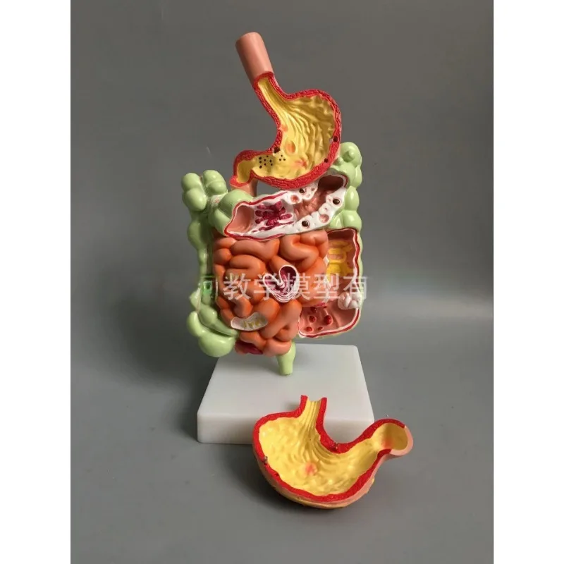 

Human Digestive System Anatomy Medical Anatomical Model Stomach Intestine Cecum Rectum Duodenum Visceral Structure Nursing