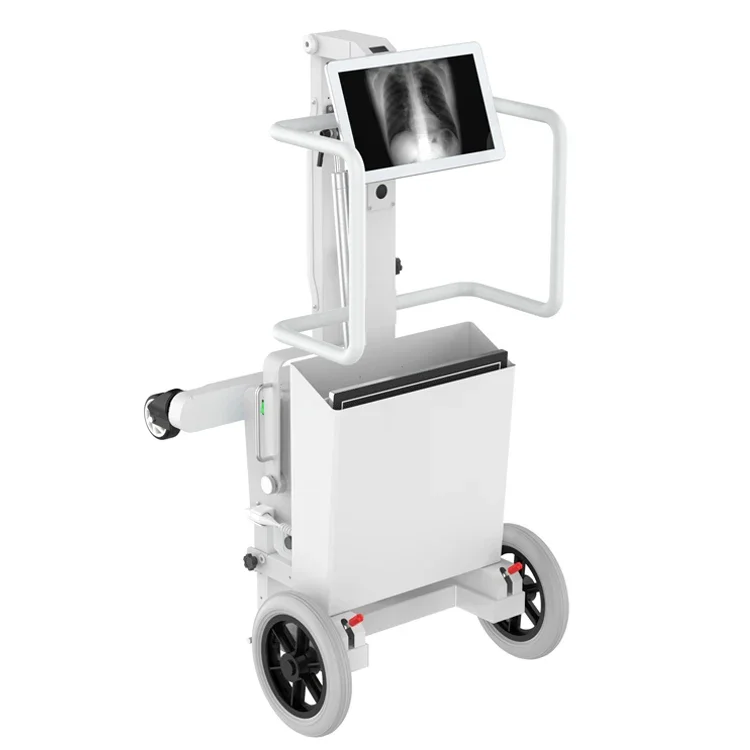 Système de Radiographie Mobile DR, Machine à Rayons
