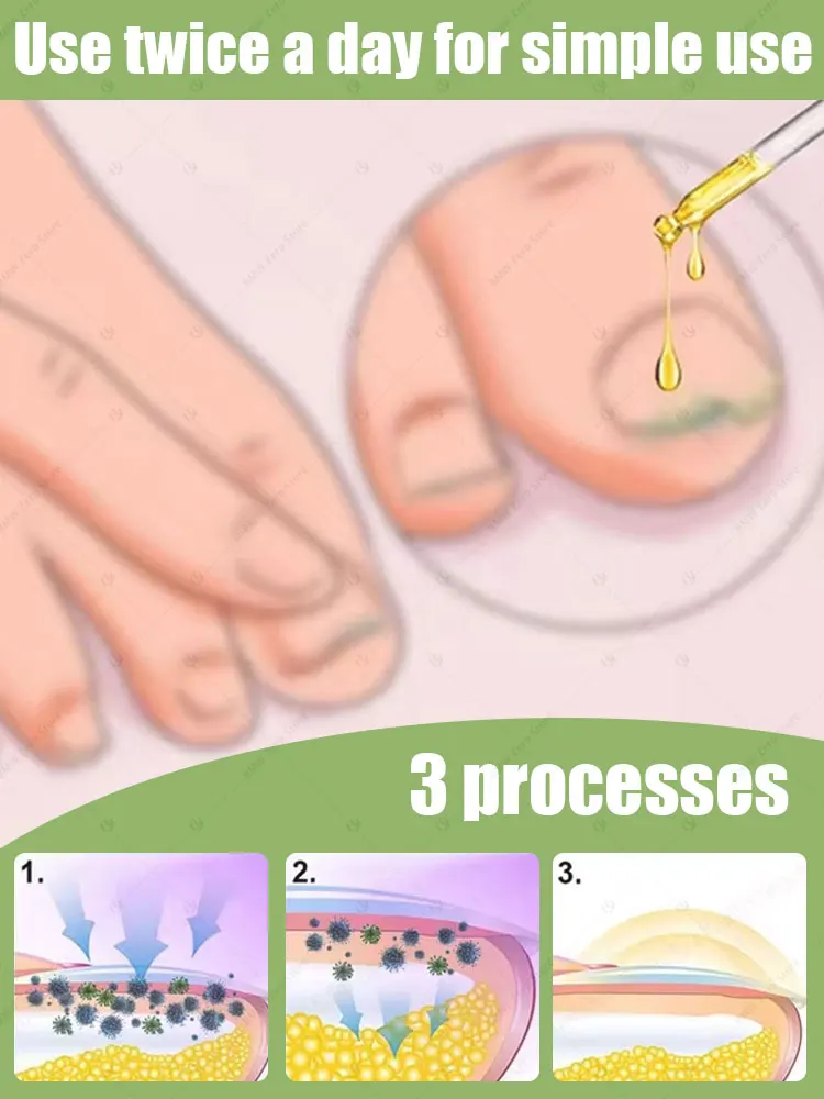 足の健康を維持するために早期に介入してください。