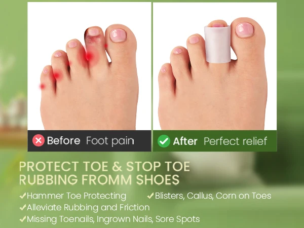 

2/6/10Pcs Soft Gel Toe Separator Foot Care Tool Toe Spacers with Aloe Essential Oil Protect Bunion Pain Corns Calluses Blisters