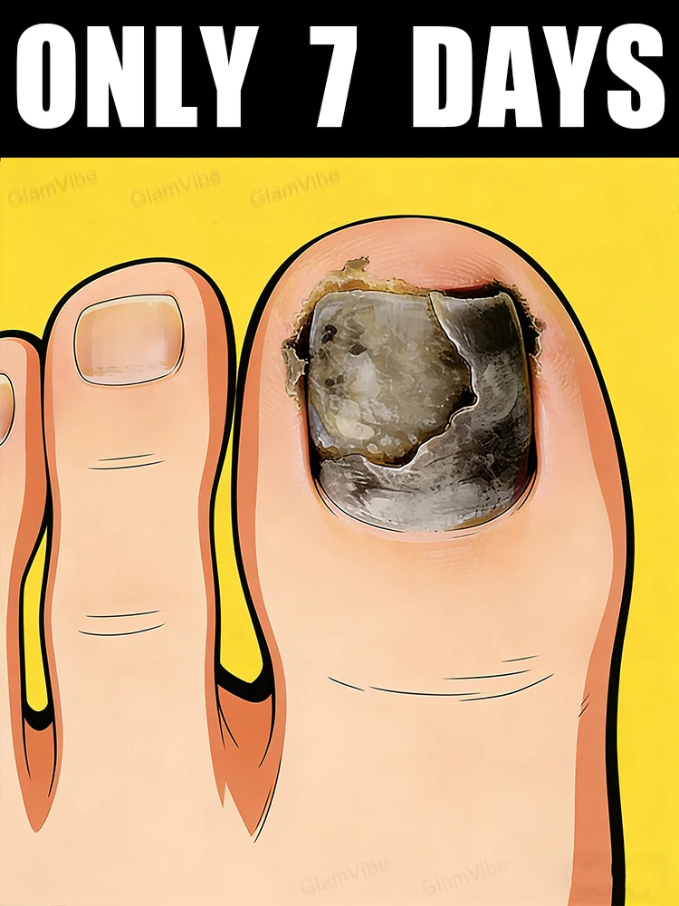 

Попрощайте грубые и тусклые ногти, восстанавливают гладкие и блестящие ногти!