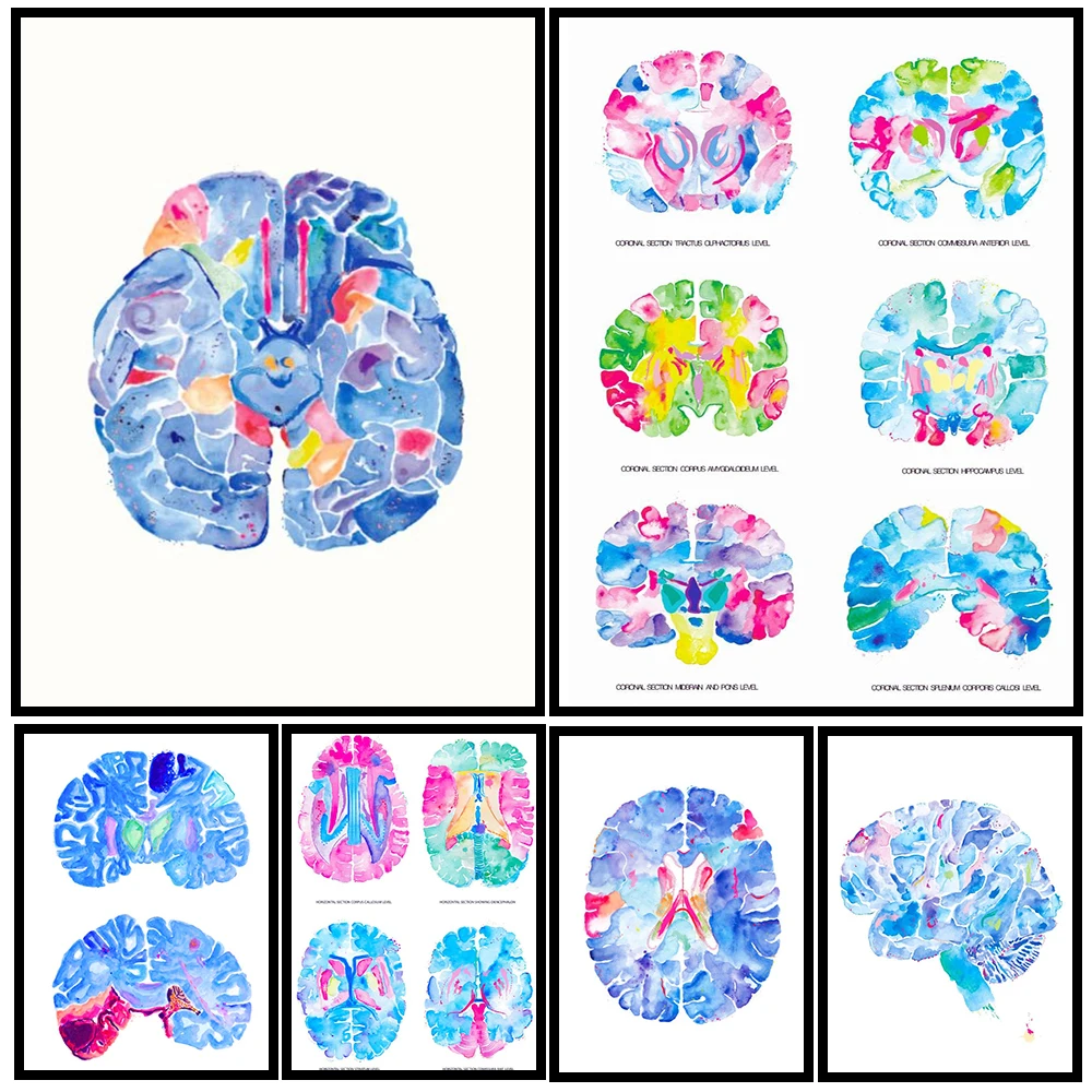 Watercolor Brain Anatomy Canvas Painting, Medical Neurology Wall Art, Colorful Brain Section Poster Print,Clinic & Office Decor
