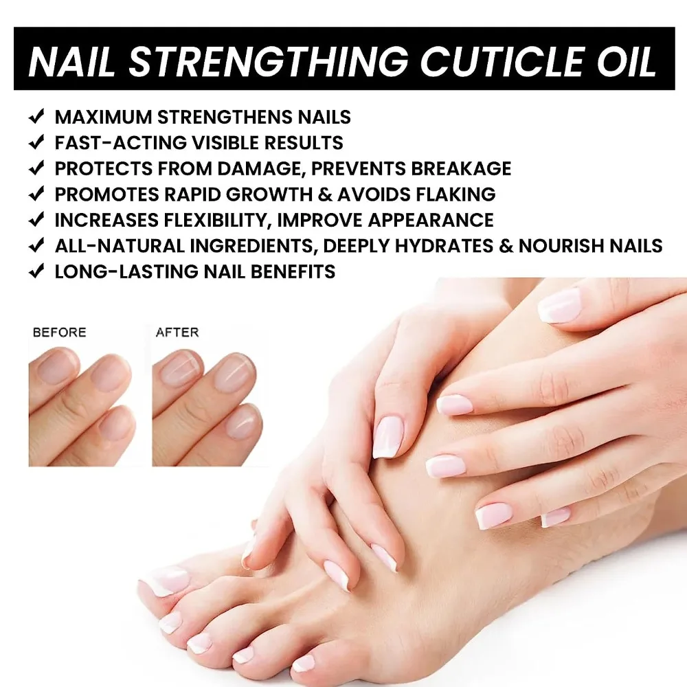 Nail Thickening Nail Strengthening Stratum corneum Oil 15ml Lavender/Tea Tree/Citrus Toenails Repair Oil Mild Rich Vitamin