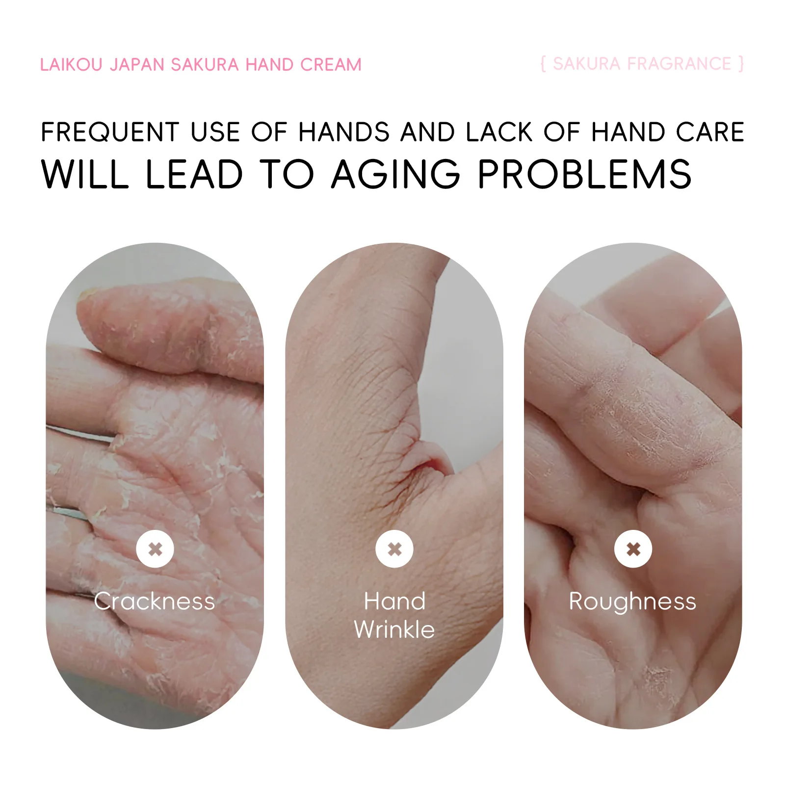 LAIKOU زهر الكرز كريم اليد ترطيب مغذي اشراق ترطيب غسول اليد الكريمات إصلاح مكثف بلسم اليد