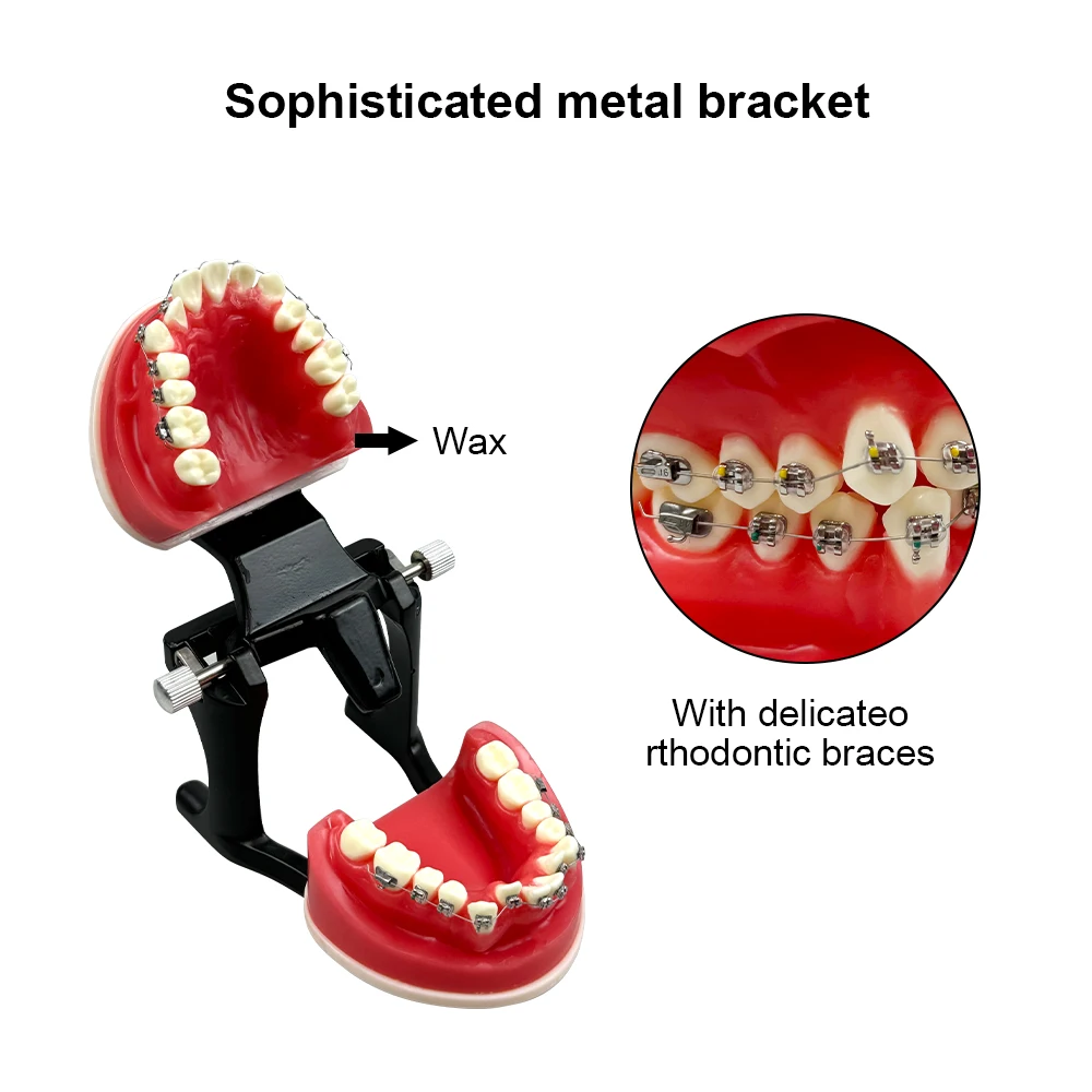 Orthodontic Teeth Practice Model Dental Red Wax Gum Tooth Metal Brackets Ligature Ties Teaching Study Communication Dentist