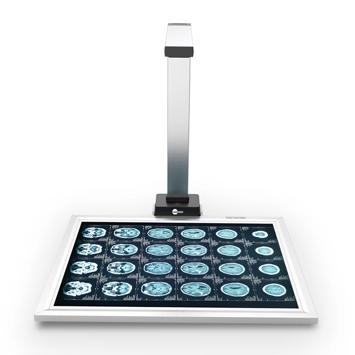 الماسح الضوئي الطبي الاحترافي ذو التنسيق الكبير لمسح مستندات فيلم CT MR X Ray وضوح معزز لواجهة USB