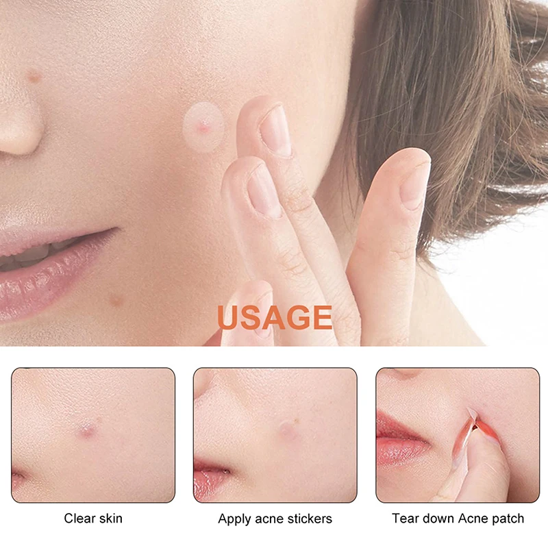36pcs/180pcs Round Transparent Acne Patch Skincare Sticker Makeup Tool - Image 4