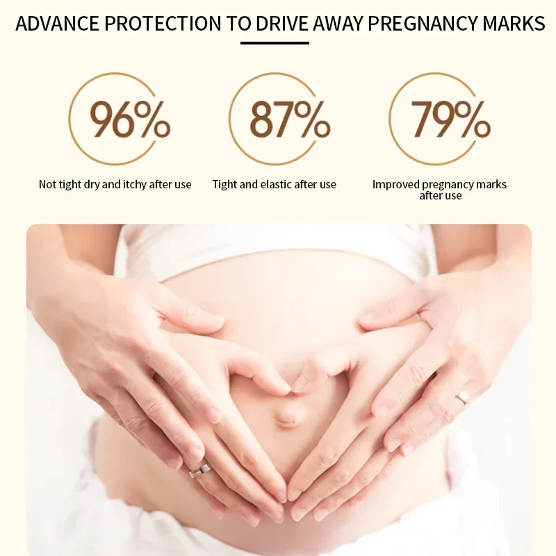 كريم إزالة علامات التمدد كريم إصلاح بعد الولادة للنساء الحوامل علامات نمو السمنة علامات الفخذ لشد البشرة #6