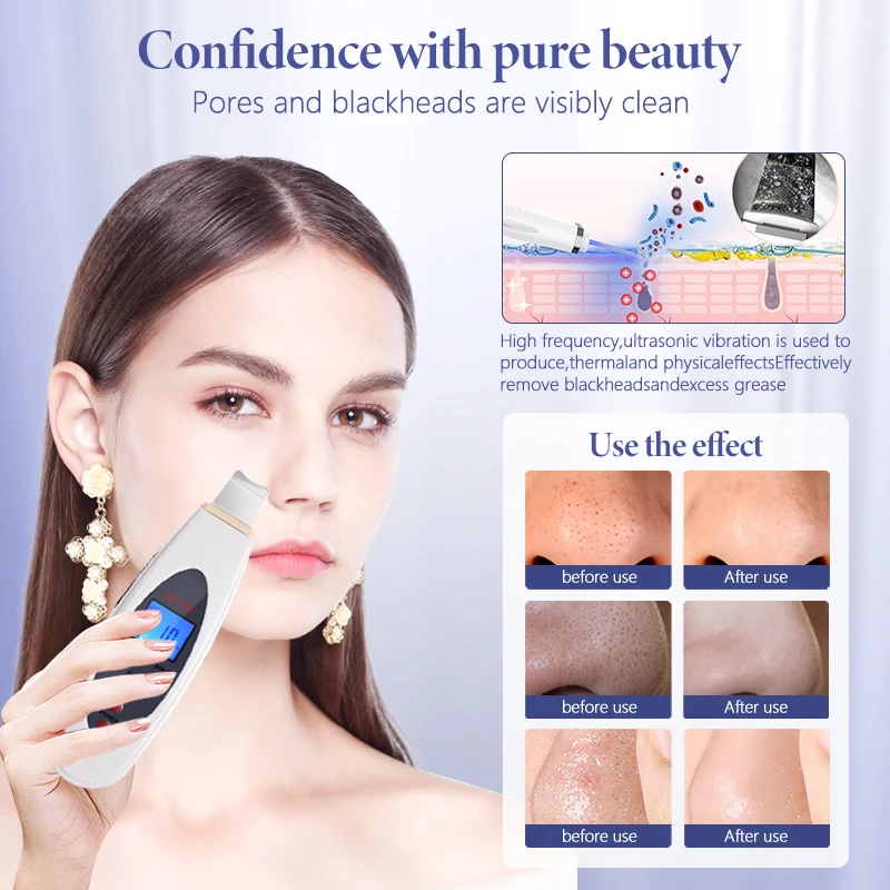 Ultrasonic Skin Scrubber Deep Face Cleaning Machine RemoveFacial Massager Ultrasound Peeling Clean Tone Lift LW006