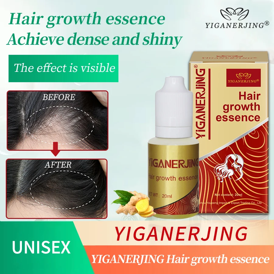 YIGANERJING-aceite para el crecimiento del cabello, líquido de belleza Natural para el crecimiento del cabello, esencia Herbal china para el cuidado del cuero cabelludo, 5 piezas, 20ML