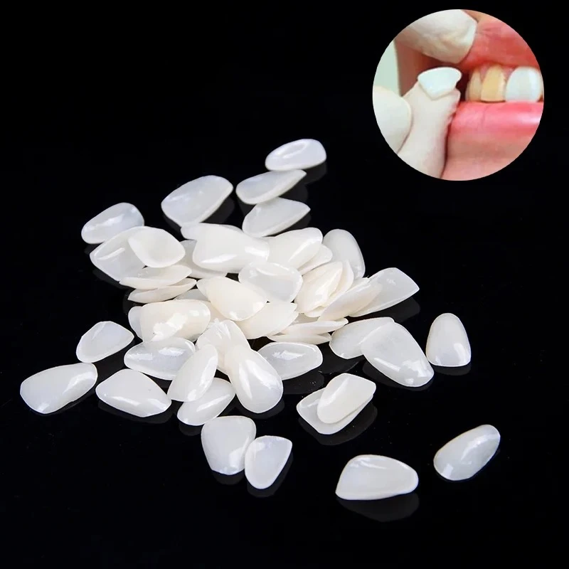 

15×50pcs/bag Dental Teeth Veneers Temporary Crown Ultra-Thin Resin For Dentistry Teeth Protecting Oral Care