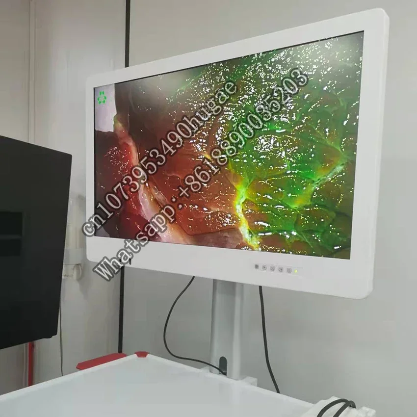 4k 32 inch professional endoscopic medical monitors for laparoscopico