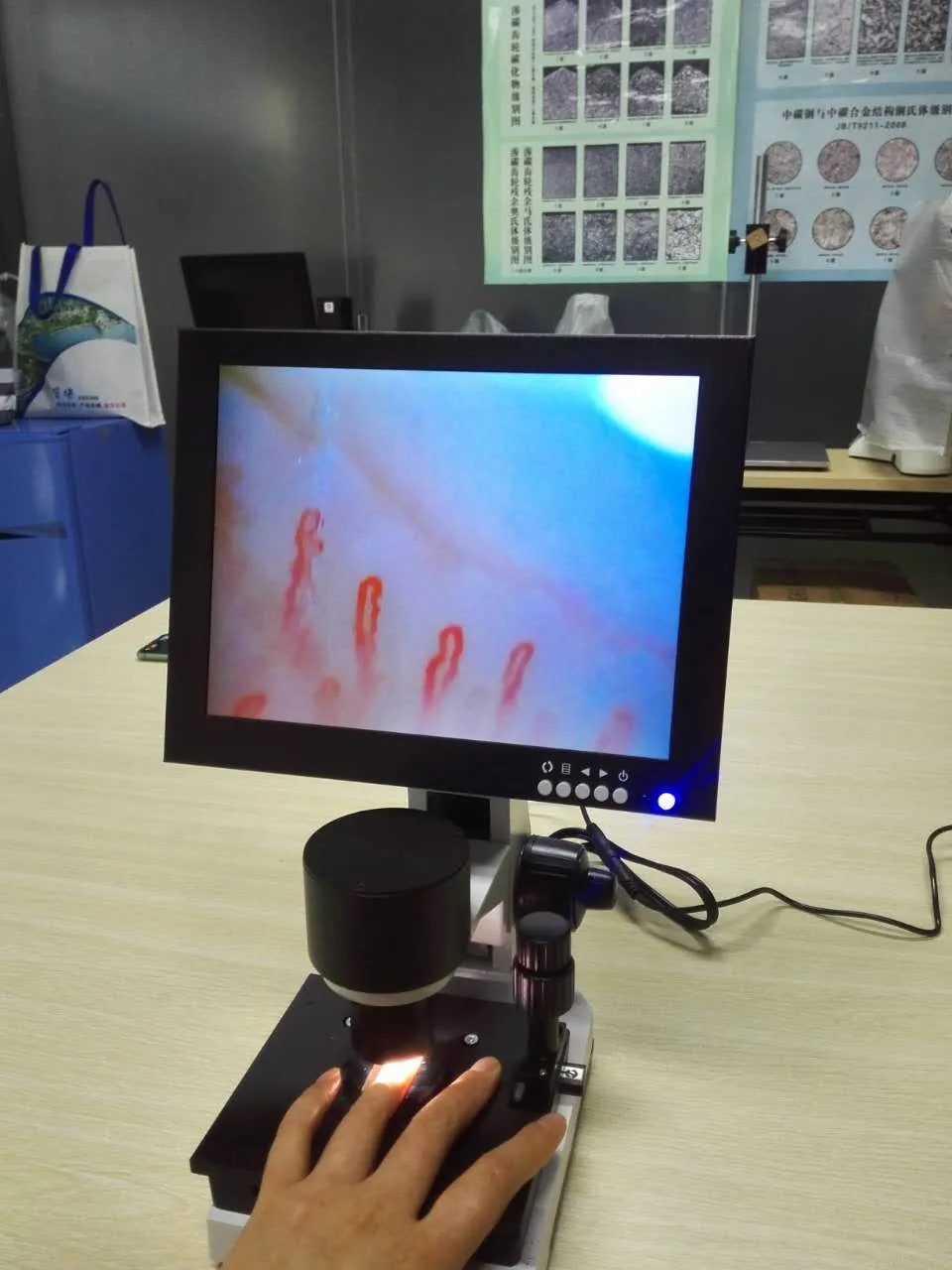 Nailfold Video Capillaroscope Detection Instrument Capillary Microcirculation Microscope