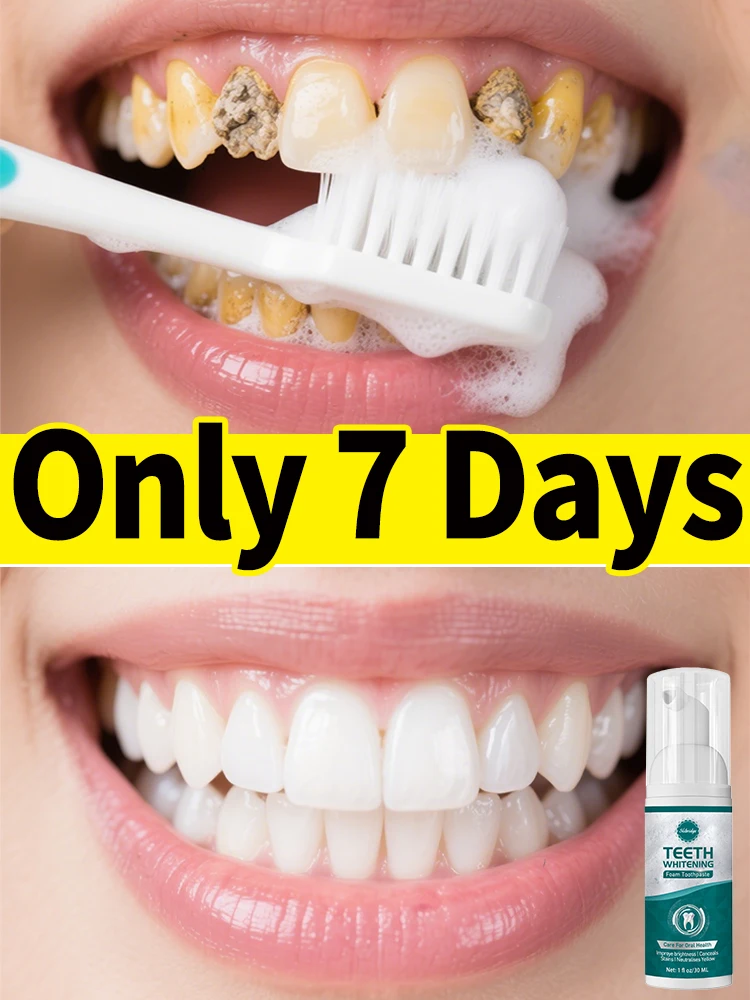 

2025 new tartar removers dissolve tartar and remove stains 100% natural