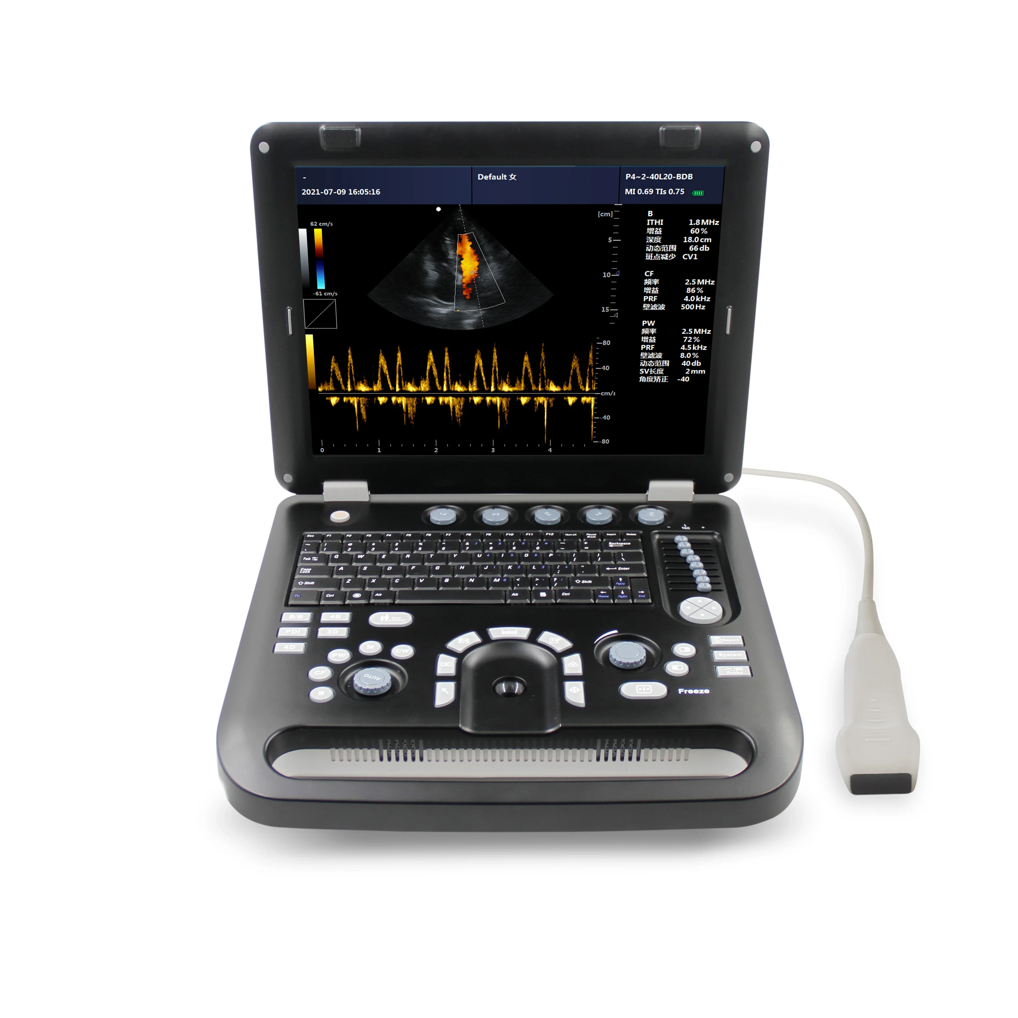 CONTEC CMS1700B Color Doppler USG Color Cardiac Ultrasound Scanner Diagnostic Machine Systems Phased Array Probe