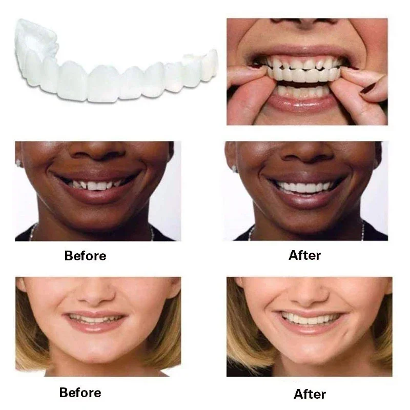 Perfect Fit Silicone branqueamento dentes, falso tampa do dente, Snap On, sorriso folheados, ferramenta de beleza superior, dentadura cuidados