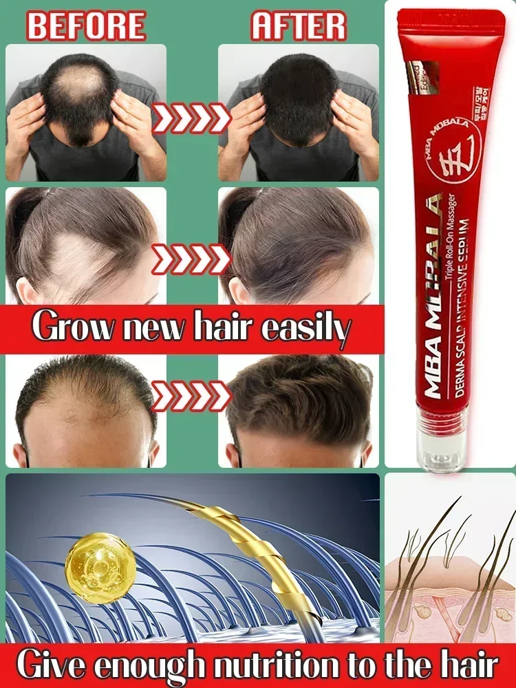 Tratamento líquido do crescimento do cabelo para homens e mulheres, perda do Anti-cabelo, tratamento