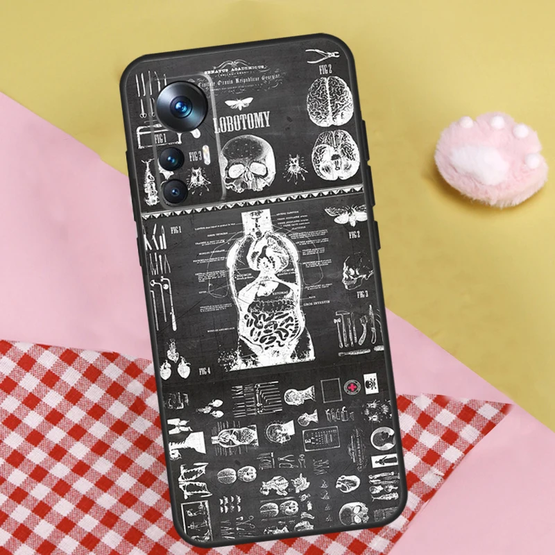 Radiological Human Organs Skeleton Case For Xiaomi 13 13T Pro 12T 11T 12 Lite 12X POCO X3 X5 Pro X4 F4 GT M5 M5s F3 F5 Funda