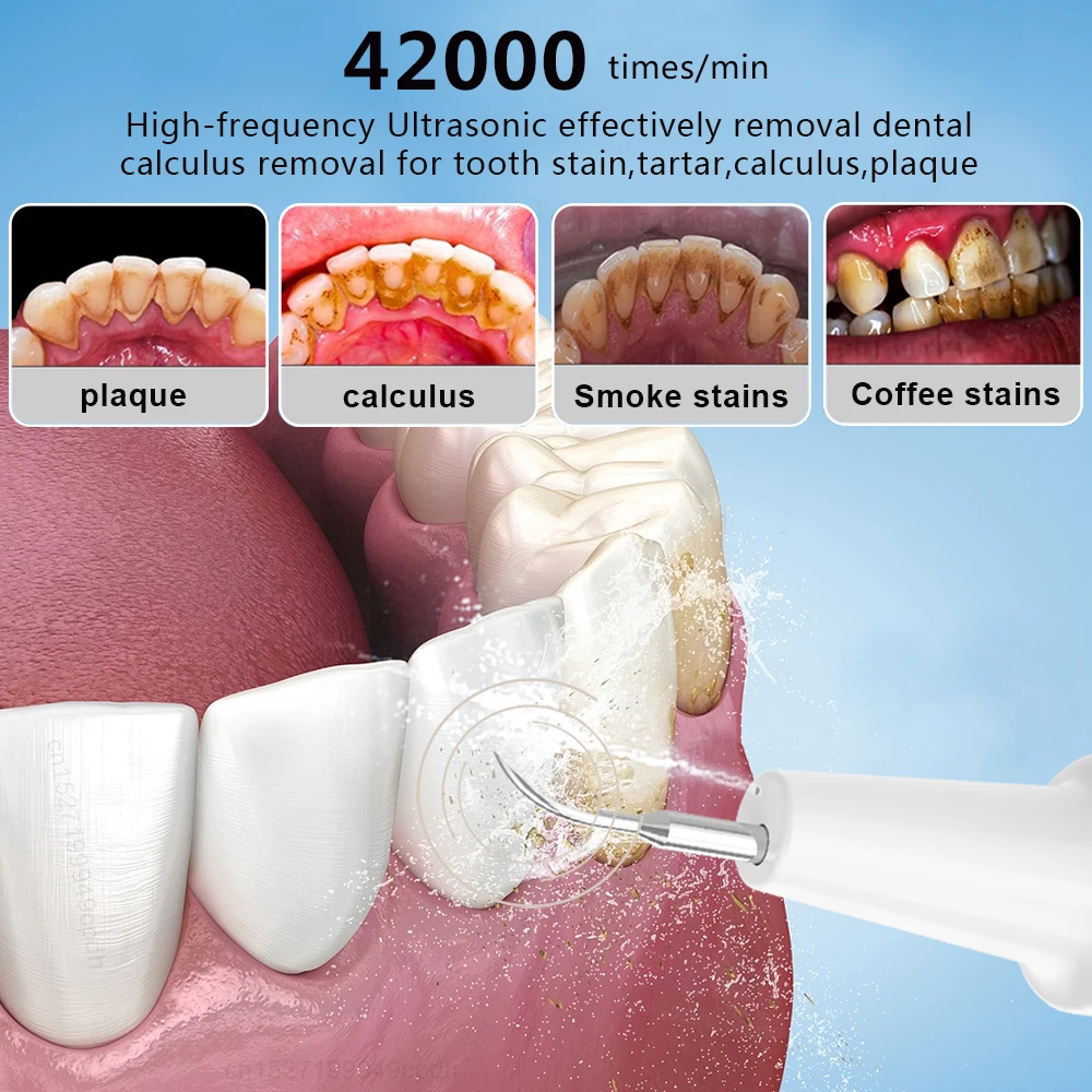Water Flosser Portable Dental Scaling 2 in 1 Tartar Eliminator Removal Plaque Teeth Stone Stain Remover Calculus for Tooth Clean