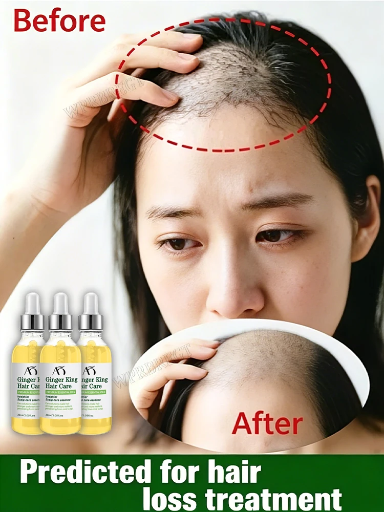 Hair Care Step - 잠자는 모낭을 깨워 정밀하고 간편한 원스텝