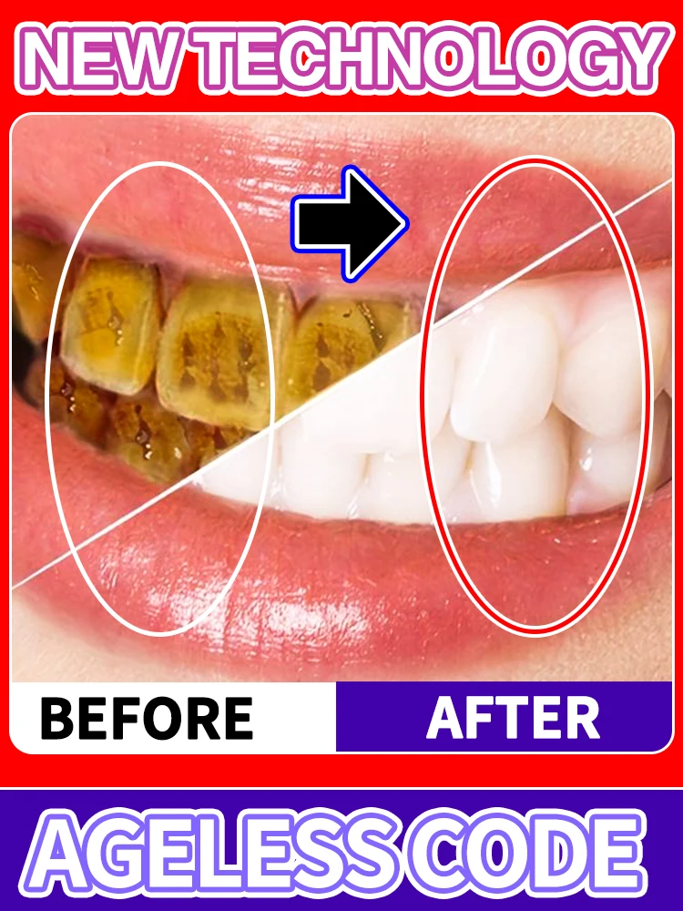 

Quick Dental calculus Removal mousse Teeth Whitening Permanent Dental Foam Removal