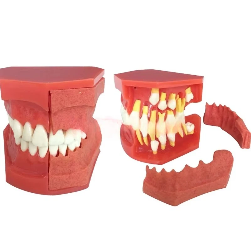1Pcs Dental Teaching Teeth Model Children's Primary and Permanent Teeth Alternate Model Milk and Permanent Teeth Replacement