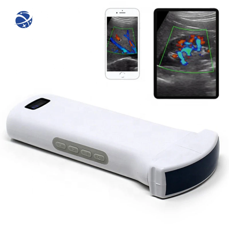 

C6C Convex Pregnancy Color Doppler Ultrasound Pocket Portable Wireless Ultrasound Scanner Probe