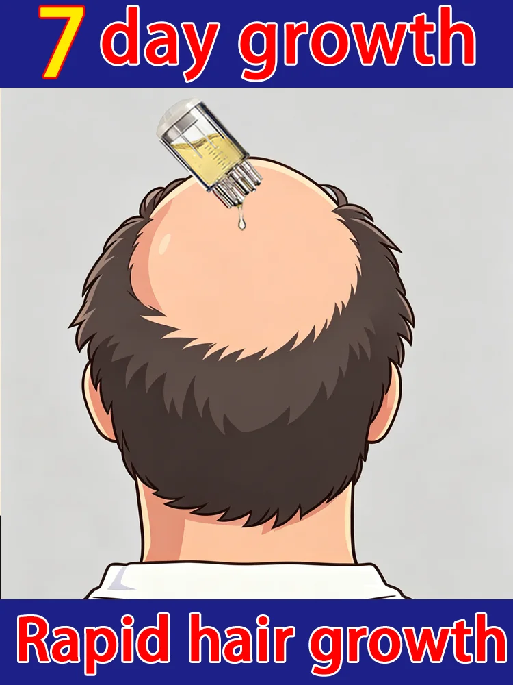 

Средство для роста волос с розмарином: восстановление сухих и поврежденных волос, предотвращение пушистости, питание и увлажнение кожи головы