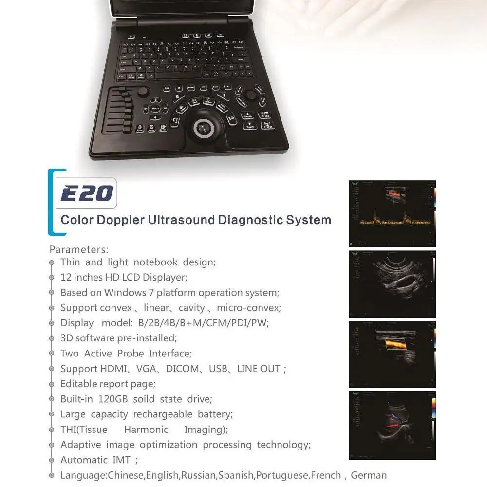 Pasture Portable Color Ultrasound Diagnostic Instrument 12-inch Veterinary Color Ultrasound Machine