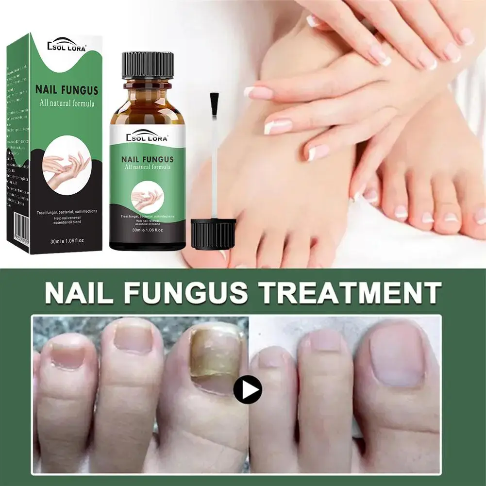 Sérum de réparation des ongles décolorés endommagés aux scanner, essence de bain renforcée, solution rapide N64.Solution, anti-Bri, Y2H6