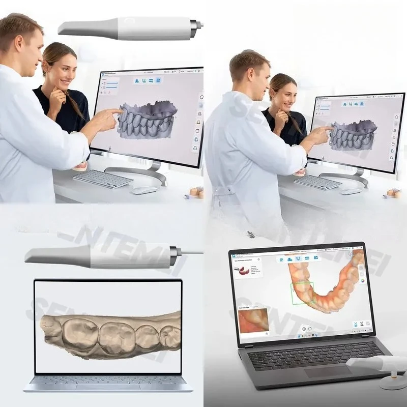 Fast Scanning 3D Intraoral Scanner High Accuracy 10μm Full Arch Portable Digital Scanner for Prosthesis and