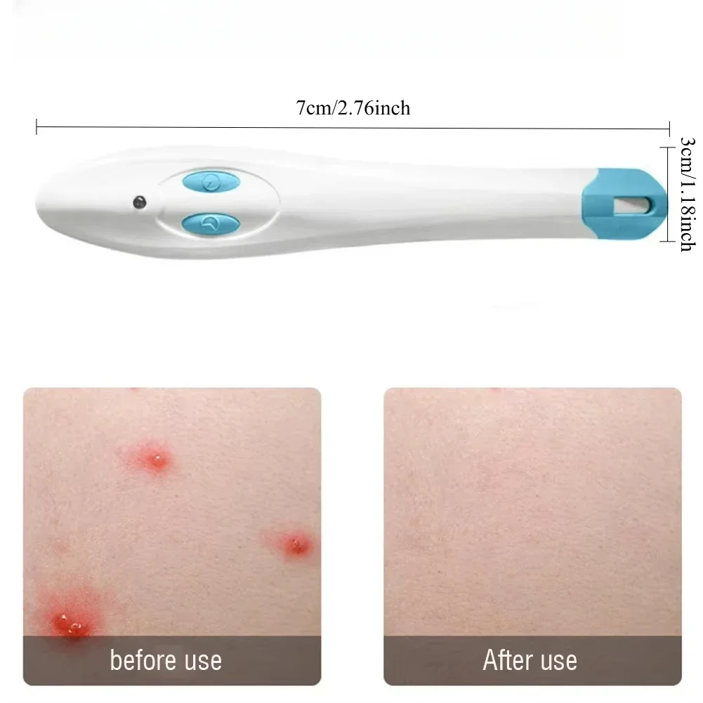 جهاز محمول مضاد للحكة الذي لدغات الحشرات مناسب للاستخدام المنزلي الخارجي فعال لتخفيف الحكة وقلم مضاد للحكة