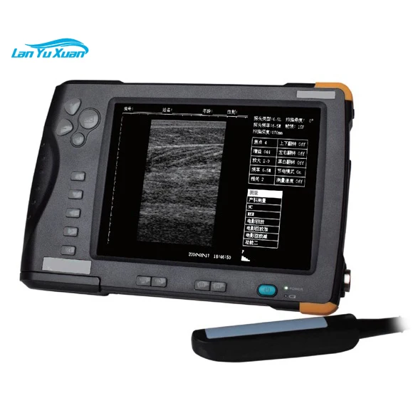 

KBW-V5 Palm Ultrasound Scanner(ultrasonicblack whiteImaging System)