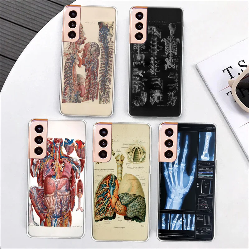 Medical Human Organs Brain Phone Case For Samsung A34 A54 Galaxy A02S A12 A22 A32 A42 A52 A52S A72 A71 A51 5G A41 A31 A21S A11 A