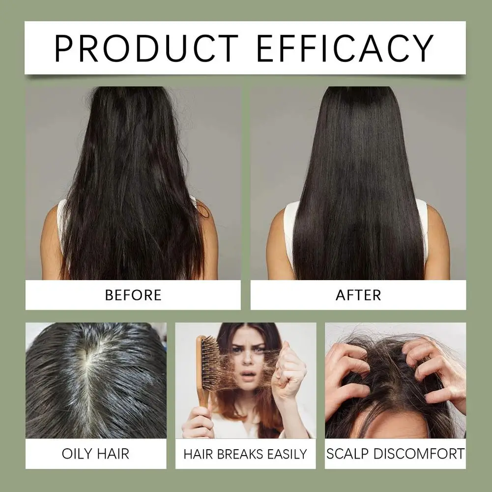 

Rosemary Shampo For Hair Care Strengthening Improve Dry Damaged Hair Cleaning Scalp Anti Dandruff Thickening Hair Care