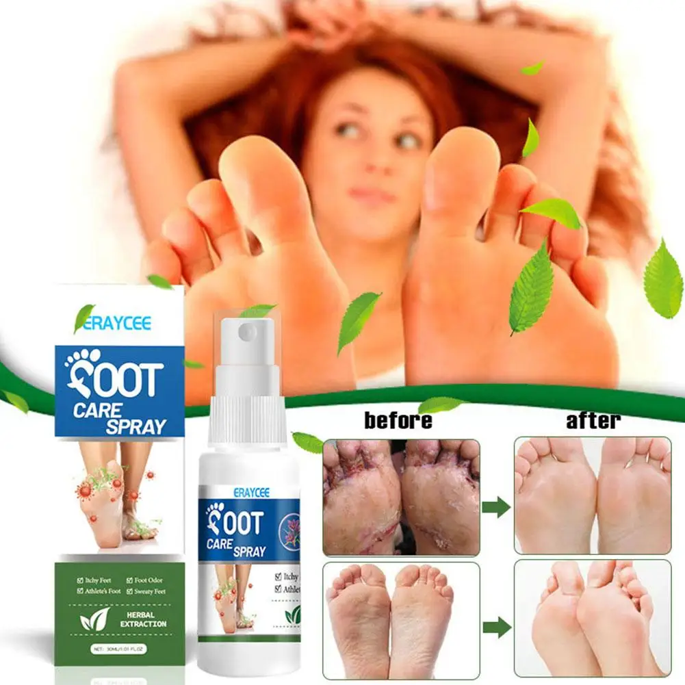 30ml Foot Deodorant Spray Relieve Itching Eliminate Odor Athlete\'s Of The Foot Care Foot Anti-Sweat Removal Spray Moisturiz K1Z0