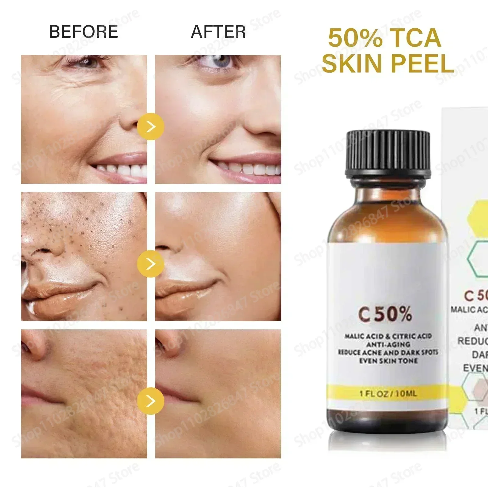 Высокое качество 50% химический отшелушивающий пилинг Tca Peel Acid Skin Superforce Пигментация Осветление меланина Акне Уход за красотой