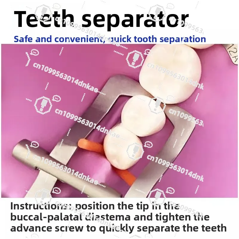 Separator Oral Tooth Separator Tooth Interspace Dental Rubber Barrier Tooth Interspace Expansion Flare Front and Rear Teeth