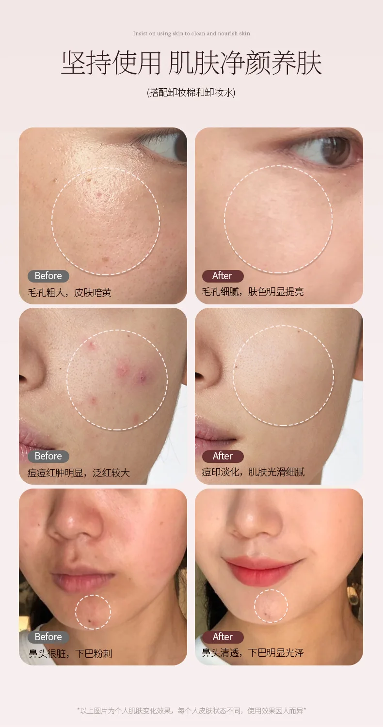 フェイシャルマッサージ マイクロカレント クレンジング フェイスリフト デバイス ミニスキンケア 美肌若返り 電子