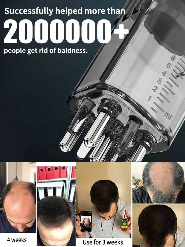 100% revive hair, strong penetration, activate hair roots, more hair, say goodbye to baldness, thick hair