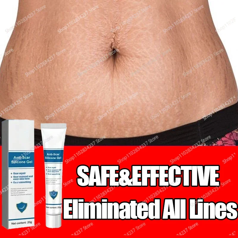 Old Stretch Marks Creme para Mulheres Grávidas, Eliminar Vermelho e Branco