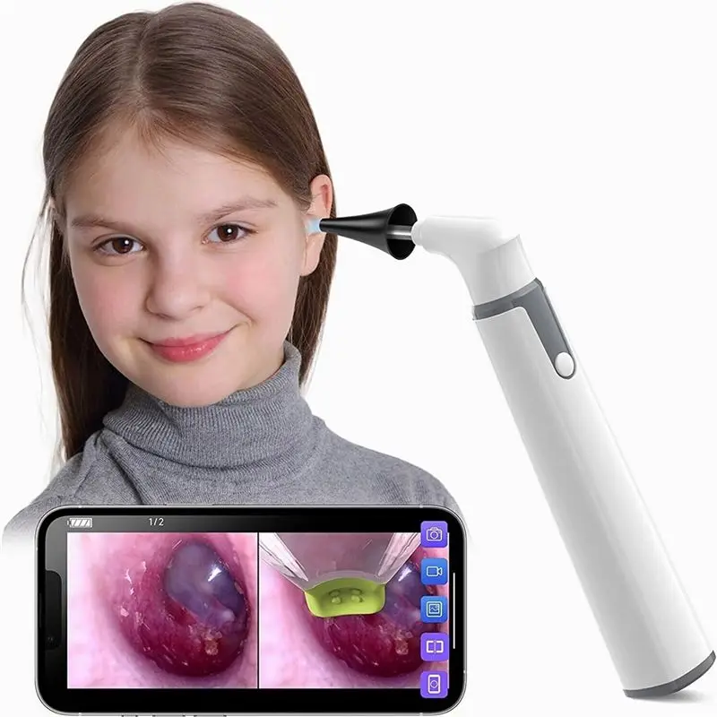Y45A-Teslong SA39W Ear Endoscope Camera Ear Wax Cleaner Camera For Ears Nose Support IOS Android