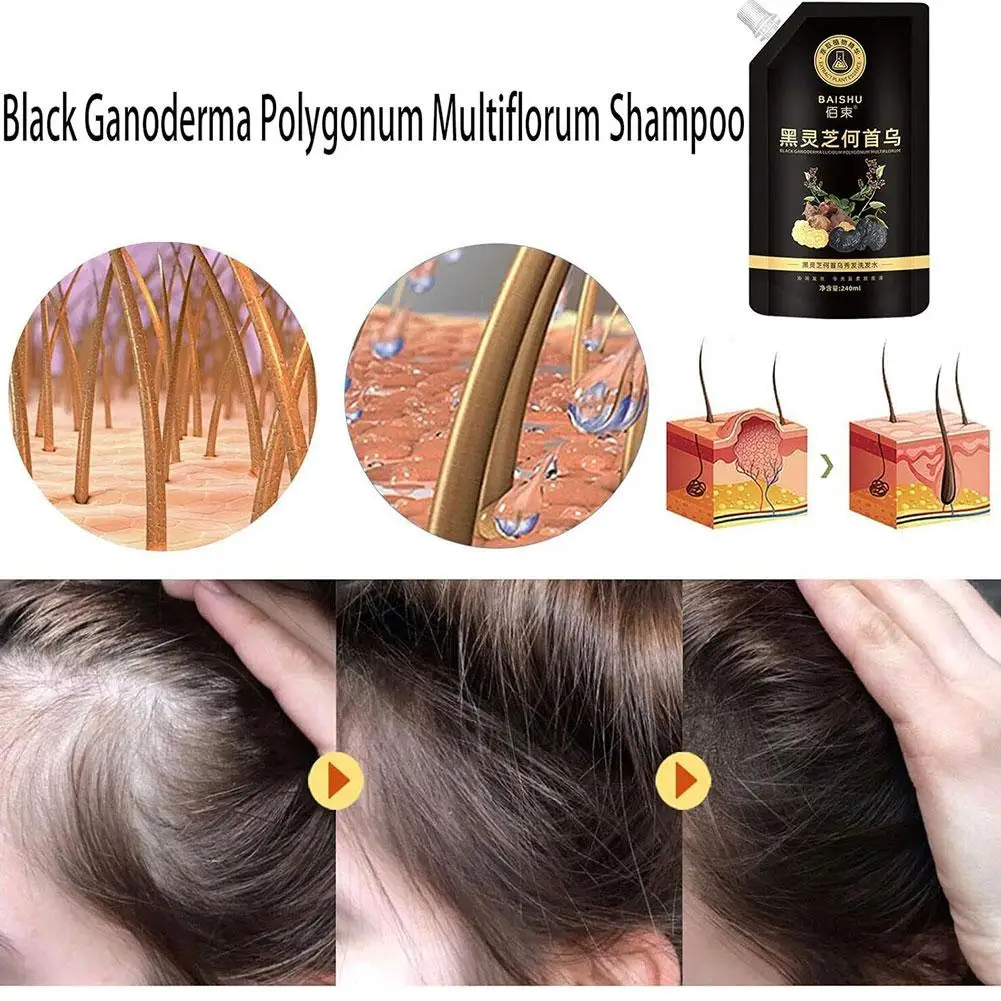 Polygonum Multiflorum Shampoo For White Hair Turns to Black Professional Blackening Growth Hair Nourishing Care Prevent Hair Los