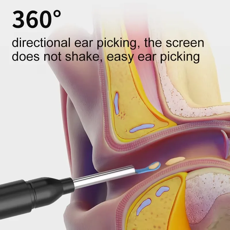 Ear Pick Smart Visible Ear Pick for Home Use with Wi-Fi Connection for Ear Cleaning Device