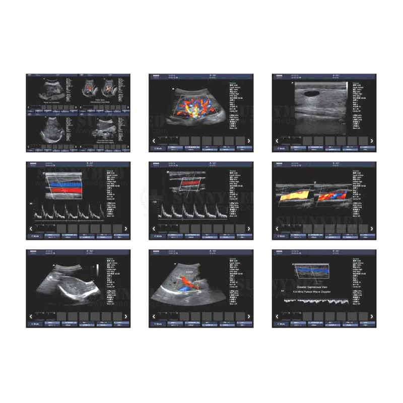 Color Doppler 3D Ultrasound Machine for Breeding farms pet hospitals Human Veterinary Multifunction Portable Ultrasound Machine