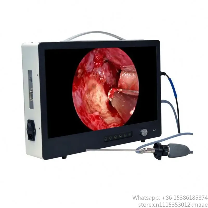 Medical ENT Endoscopy System 1080P Full HD Portable USB All-in-One Endoscope Camera